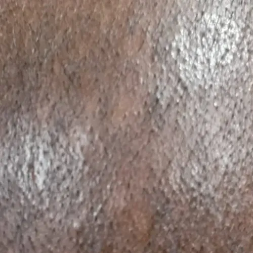 Vibha skin, hair and laser cli