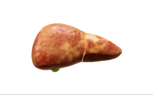 update image