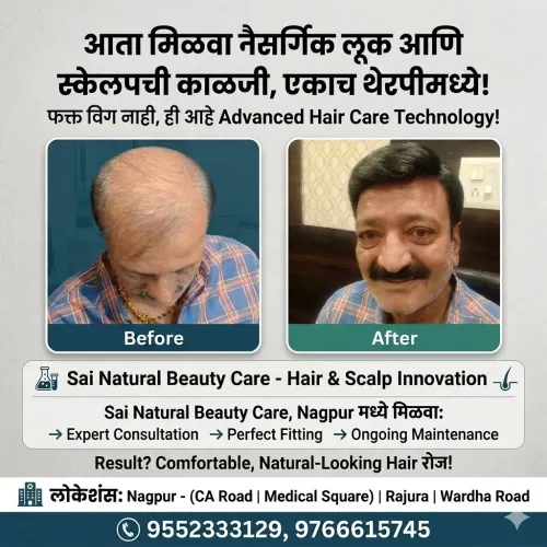A fullarhead of hair can change the way 