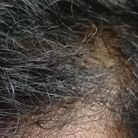 Vibha skin, hair and laser cli