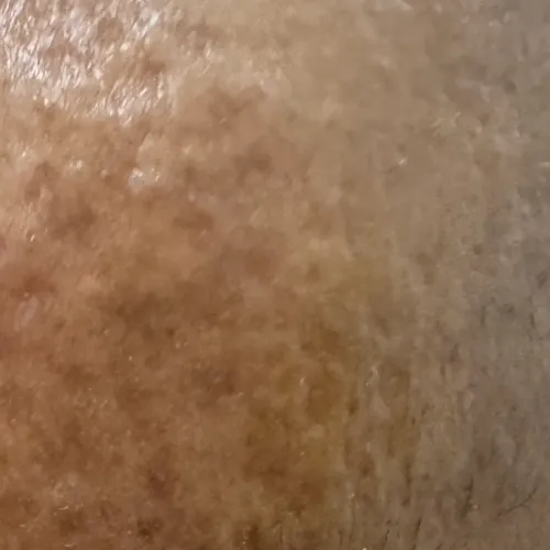 Vibha skin, hair and laser cli