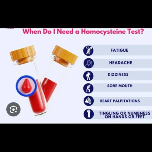 A homocysteine blood test meas