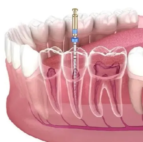 best orthodontist for braces p