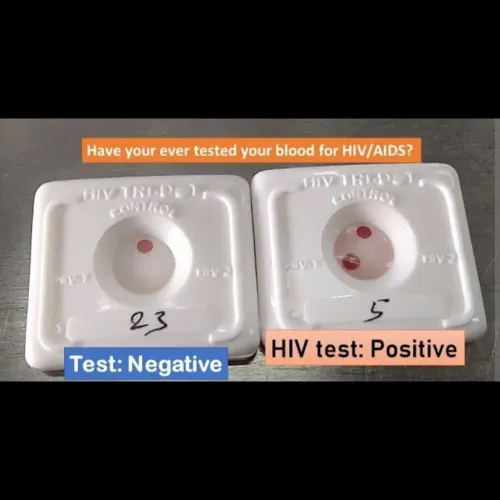 buy HIV TRIDOT test kit online