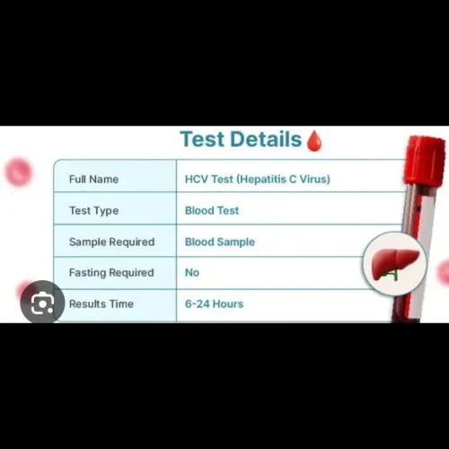An HCV blood test screens for 