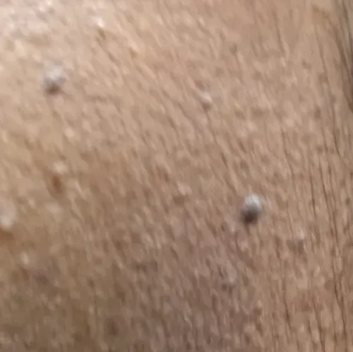 Vibha skin, hair and laser cli