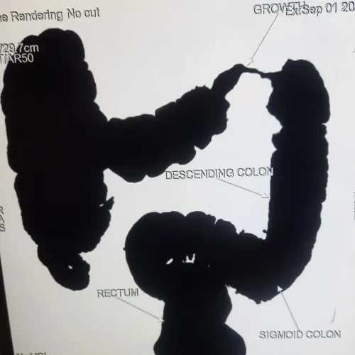 update image