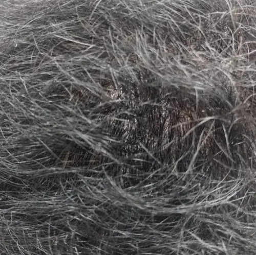 Vibha skin, hair and laser cli