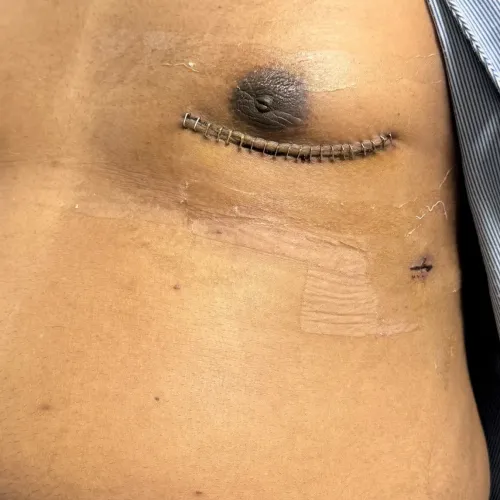 update image