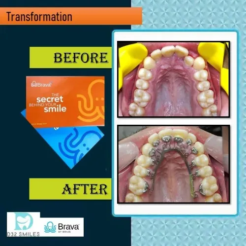 update image