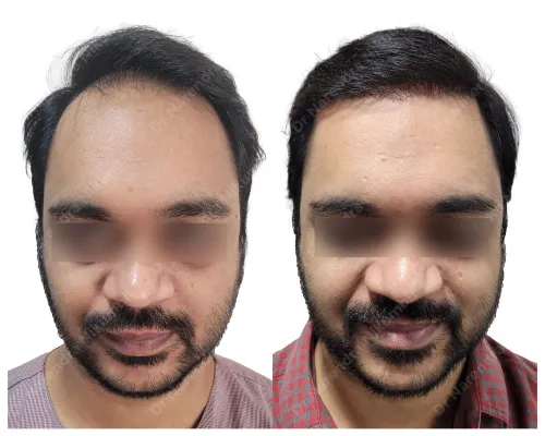 update image