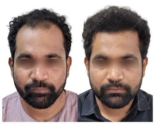 update image