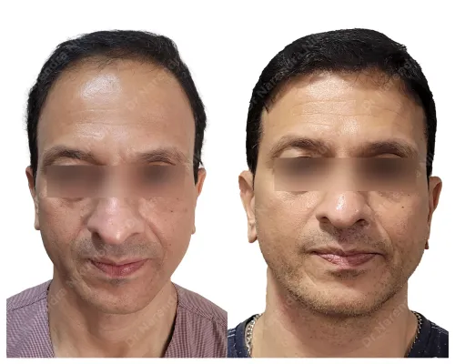 update image