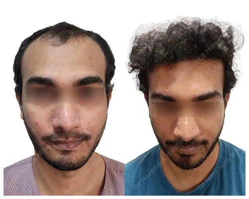 update image
