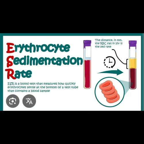 An Erythrocyte Sedimentation R