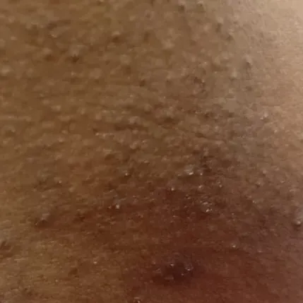 Vibha skin, hair and laser cli