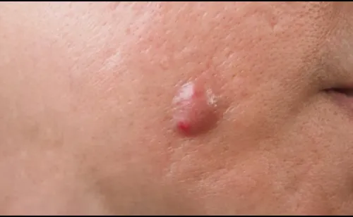 update image