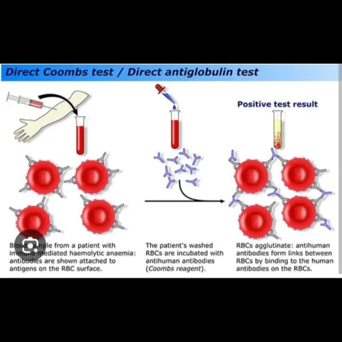 A DCT, or 