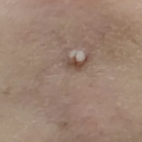 Vibha skin, hair and laser cli