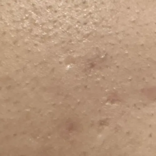 Vibha skin, hair and laser cli