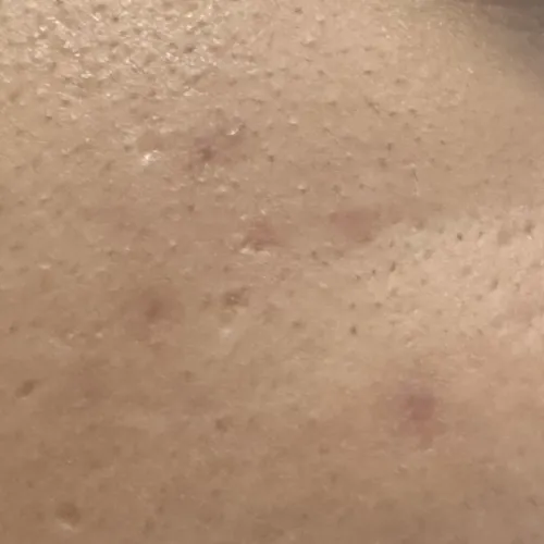 Vibha skin, hair and laser cli
