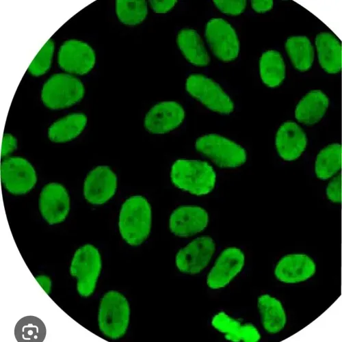An ANA by IFA test is a blood 