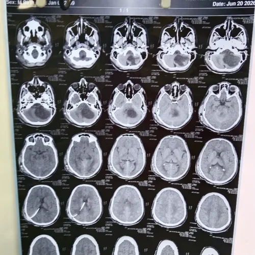 update image