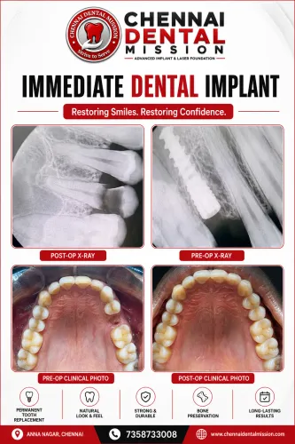 update image