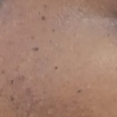 Vibha skin, hair and laser cli
