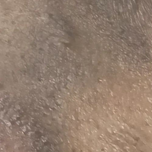 Vibha skin, hair and laser cli