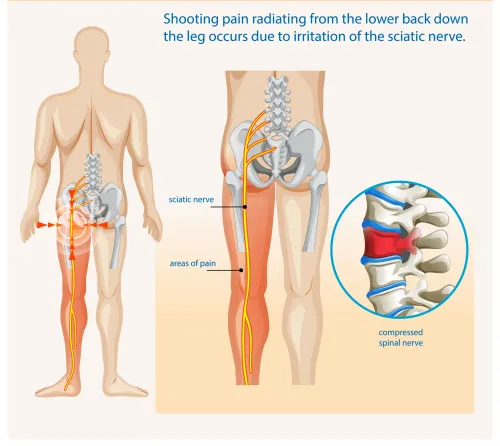 update image