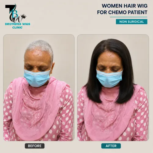  Women Hair Wig For Chemo Pati