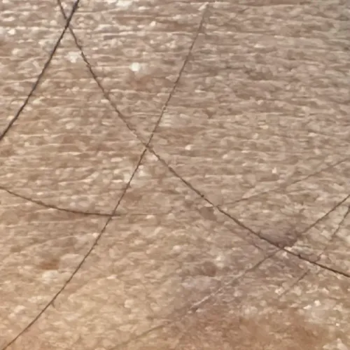 Vibha skin, hair and laser cli