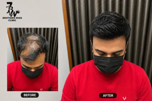 wig hair patch hair system in 