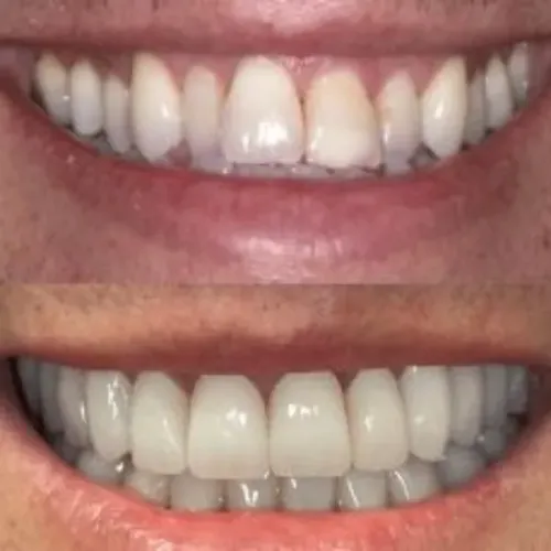 update image