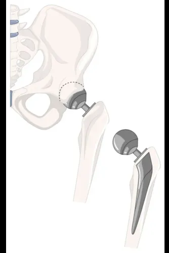 update image