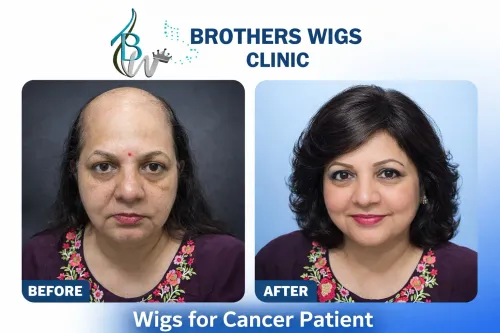 Hair Wig for Women