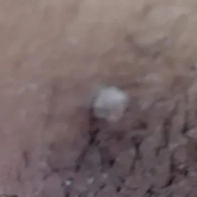 Vibha skin, hair and laser cli