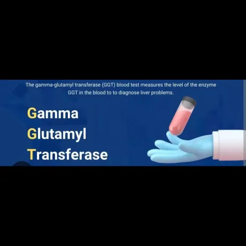 A GGT (Gam