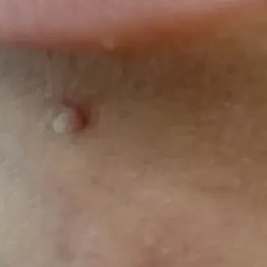 Vibha skin, hair and laser cli
