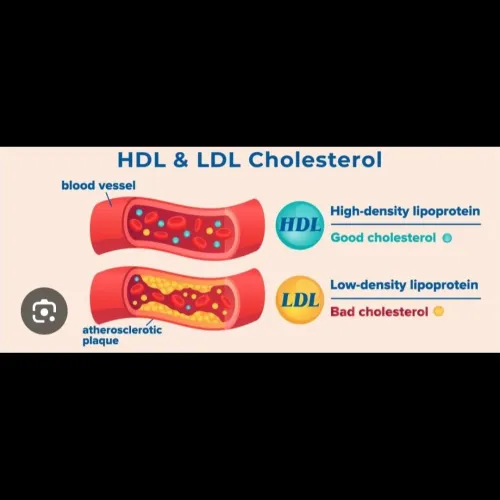 An HDL cho