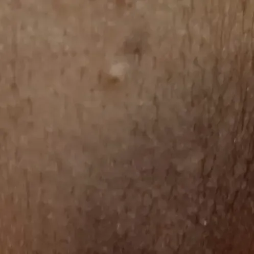 Vibha skin, hair and laser cli