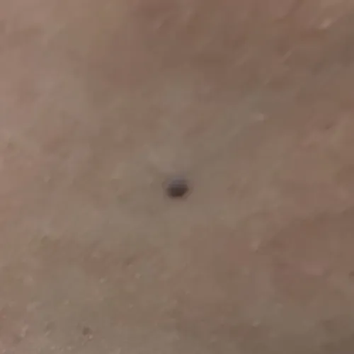 Vibha skin, hair and laser cli