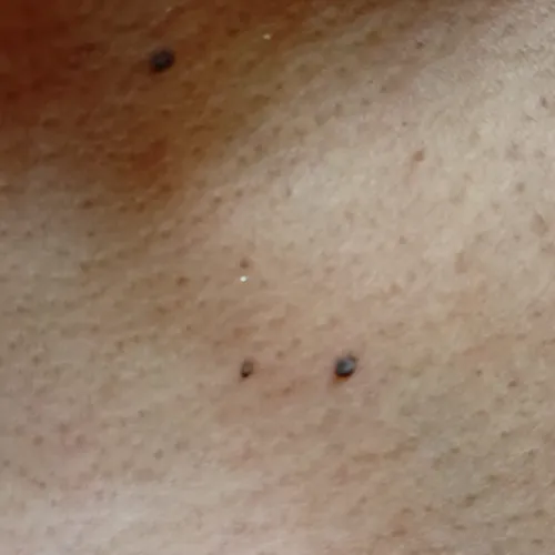 Vibha skin, hair and laser cli
