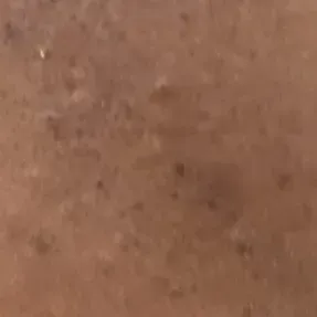 Vibha skin, hair and laser cli