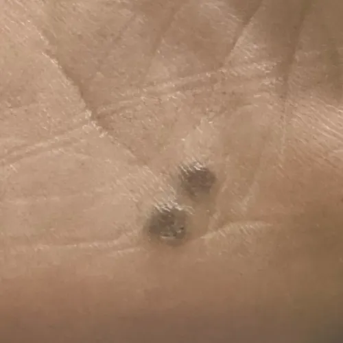 Vibha skin, hair and laser cli