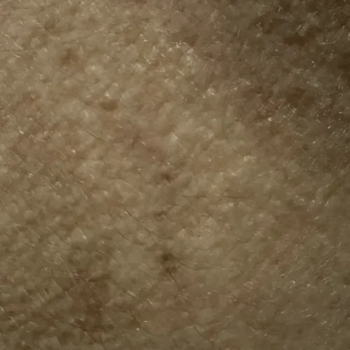 Vibha skin, hair and laser cli