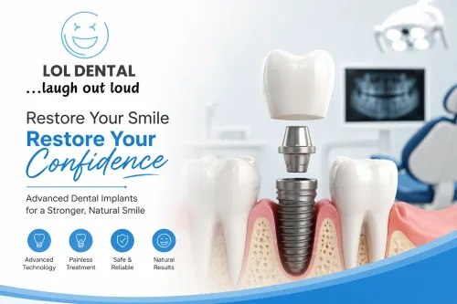 Best Dental Implant Doctor In 