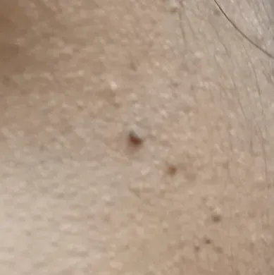 Vibha skin, hair and laser cli