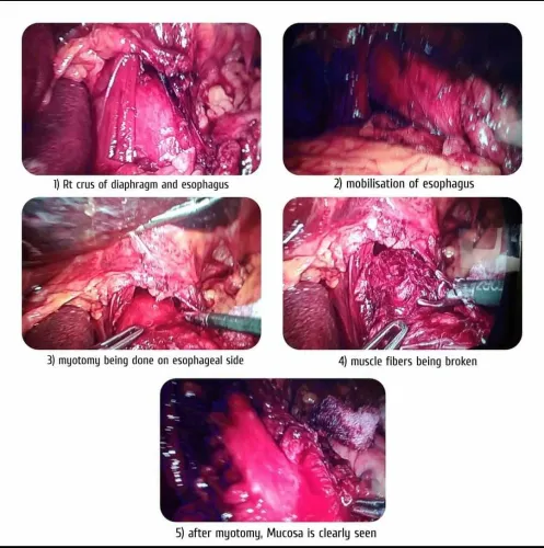 update image